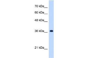 C19ORF47 antibody used at 0. (C19orf47 抗体  (C-Term))