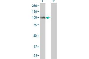 Western Blot analysis of FOXM1 expression in transfected 293T cell line by FOXM1 monoclonal antibody (M01), clone 3A9. (FOXM1 抗体  (AA 702-801))