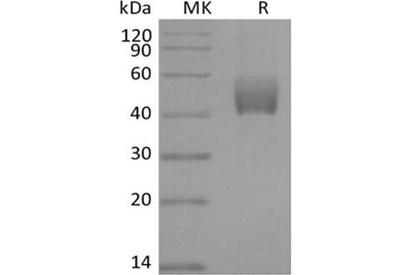 TGFBR1 Protein (Fc Tag)