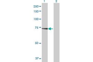 Western Blotting (WB) image for USP2 293T Cell Transient Overexpression Lysate(Denatured) (ABIN1334397)