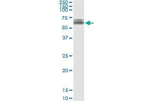 Immunoprecipitation of KLHDC4 transfected lysate using anti-KLHDC4 MaxPab rabbit polyclonal antibody and Protein A Magnetic Bead , and immunoblotted with KLHDC4 purified MaxPab mouse polyclonal antibody (B01P) . (KLHDC4 抗体  (AA 1-520))