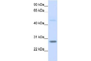WB Suggested Anti-FBXO25  Antibody Titration: 0. (FBXO25 抗体  (N-Term))
