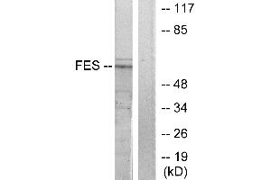Western blot analysis of extracts from HUVEC cells, treated with serum (20%, 30mins), using FES antibody. (FES 抗体  (Internal Region))