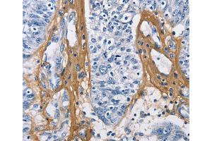 Immunohistochemistry (IHC) image for anti-Collagen, Type III, alpha 1 (COL3A1) antibody (ABIN2427981) (COL3A1 抗体)