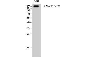 Western Blotting (WB) image for anti-Polycystic Kidney Disease 1 (Autosomal Dominant) (PKD1) (pSer910) antibody (ABIN3173025) (PKD1 抗体  (pSer910))