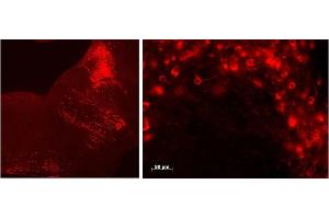 Immunohistochemistry (0. (Tryptophan Hydroxylase 2 抗体  (Internal Region))