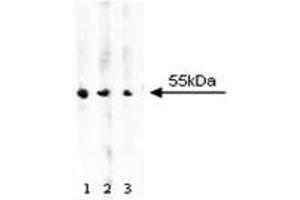 Western Blotting (WB) image for anti-Aldehyde Dehydrogenase (ALDH) (AA 7-128) antibody (ABIN968410) (Aldehyde Dehydrogenase 抗体  (AA 7-128))
