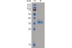 IGFBP7 Protein (AA 30-282) (His tag)