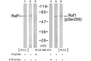 Image no. 2 for anti-V-Raf-1 Murine Leukemia Viral Oncogene Homolog 1 (RAF1) (pSer259) antibody (ABIN196619) (RAF1 抗体  (pSer259))