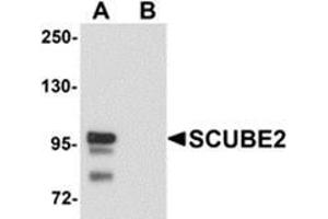 Western blot analysis of SCUBE2 in Daudi cell lysate with SCUBE2 antibody at 1 μg/ml in (A) the absence and (B) the presence of blocking peptide. (SCUBE2 抗体  (Center))