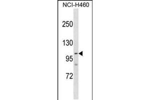 Western blot analysis in NCI-H460 cell line lysates (35ug/lane). (PARP1 抗体  (AA 590-618))