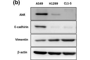 Western Blotting (WB) image for anti-Vimentin (VIM) antibody (ABIN2854814)