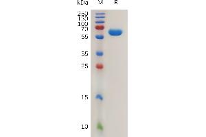 Human CA12 Protein, hFc Tag on SDS-PAGE under reducing condition. (CA12 Protein (AA 25-301) (Fc Tag))
