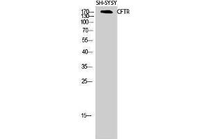 Western Blotting (WB) image for anti-Cystic Fibrosis Transmembrane Conductance Regulator (ATP-Binding Cassette Sub-Family C, Member 7) (CFTR) (Ser246) antibody (ABIN3179947) (CFTR 抗体  (Ser246))