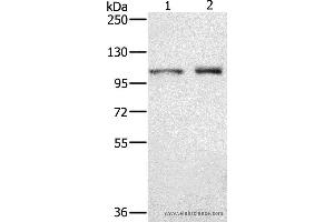 Western Blotting (WB) image for anti-Outer Dense Fiber of Sperm Tails 2 (ODF2) antibody (ABIN2430583)