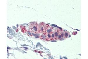 TNKS antibody was used for immunohistochemistry at a concentration of 4-8 ug/ml. (TNKS 抗体  (Middle Region))