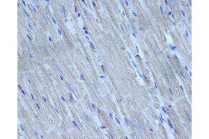 ABIN6276298 at 1/200 staining rat heart tissue sections by IHC-P. (Caspase 3 抗体  (N-Term))