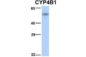 Western Blotting (WB) image for anti-Cytochrome P450, Family 4, Subfamily B, Polypeptide 1 (CYP4B1) (N-Term) antibody (ABIN2777006)