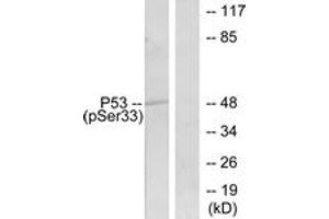 Western blot analysis of extracts from 293 cells treated with UV, using p53 (Phospho-Ser33) Antibody. (p53 抗体  (pSer33))