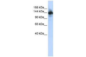 RBM6 antibody used at 2. (RBM6 抗体  (N-Term))