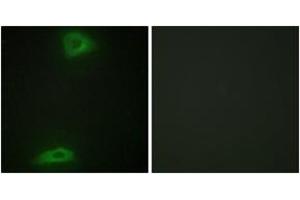 Immunofluorescence analysis of HepG2 cells, using ERGI3 Antibody. (ERGIC3 抗体  (AA 321-370))