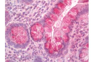 Human Small Intestine: Formalin-Fixed, Paraffin-Embedded (FFPE). (IFNA2 抗体  (HRP))