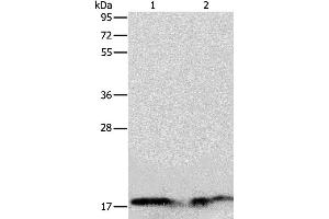 Western blot analysis of Human normal liver and fetal liver tissue, using ANG Polyclonal Antibody at dilution of 1:133 (ANG 抗体)