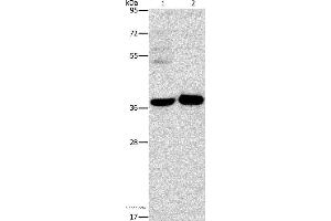 Western blot analysis of A172 cell and human fetal brain tissue, using SERPINE2 Polyclonal Antibody at dilution of 1:450 (SERPINE2 抗体)