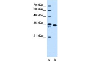 Western Blotting (WB) image for anti-Aldo-Keto Reductase Family 1, Member B1 (Aldose Reductase) (AKR1B1) antibody (ABIN2463149) (AKR1B1 抗体)