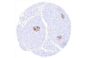 Positive NSE immunostaining of islets of Langerhans (ENO2/NSE 抗体  (AA 416-433))