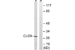 Western blot analysis of extracts from Jurkat cells, using CLDN8 antibody. (CLDN8 抗体)