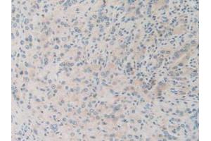 IHC-P analysis of Human Prostate Gland Tissue, with DAB staining. (SQSTM1 抗体  (AA 136-400))