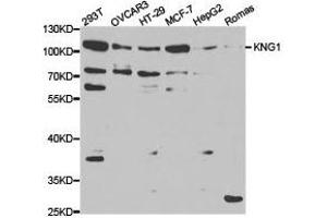 Western Blotting (WB) image for anti-Kininogen 1 (KNG1) antibody (ABIN1873454) (KNG1 抗体)