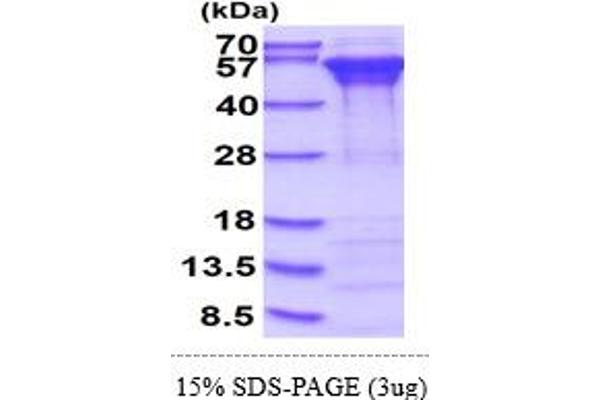 Calreticulin Protein (CALR) (AA 18-417) (His tag)