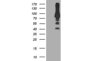 HEK293T cells were transfected with the pCMV6-ENTRY control (Left lane) or pCMV6-ENTRY PFKP (Right lane) cDNA for 48 hrs and lysed. (PFKP 抗体)