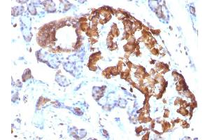 Immunohistochemistry (IHC) image for anti-Tumor Necrosis Factor alpha (TNF alpha) antibody (ABIN6940753)