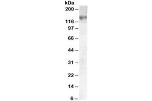 Western blot testing of A549 lysate with ABCC1 antibody at 0. (ABCC1 抗体)