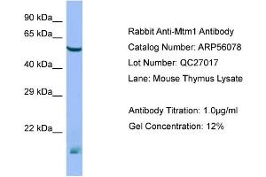 Western Blotting (WB) image for anti-Myotubularin 1 (MTM1) (N-Term) antibody (ABIN971203) (MTM1 抗体  (N-Term))