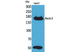 Western Blotting (WB) image for anti-rho-Associated, Coiled-Coil Containing Protein Kinase 2 (ROCK2) (Internal Region) antibody (ABIN3178224) (ROCK2 抗体  (Internal Region))