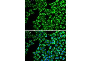 Immunofluorescence analysis of A549 cells using LIPC antibody. (LIPC 抗体)
