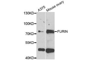 Western blot analysis of extracts of A375 and mouse ovary cell lines, using FURIN antibody. (FURIN 抗体)