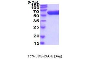 Arylsulfatase A Protein (ARSA) (AA 18-506) (His tag)