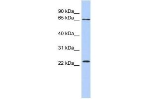 ZNF428 antibody used at 0. (ZNF428 抗体  (N-Term))