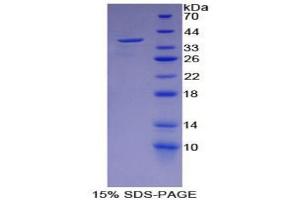 SDS-PAGE analysis of Mouse ENO2 Protein. (ENO2/NSE 蛋白)