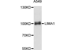 Western blot analysis of extracts of A-549 cells, using LIMA1 antibody. (LIMA1 抗体)