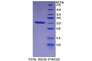 SDS-PAGE analysis of Mouse WARS Protein. (WARS 蛋白)