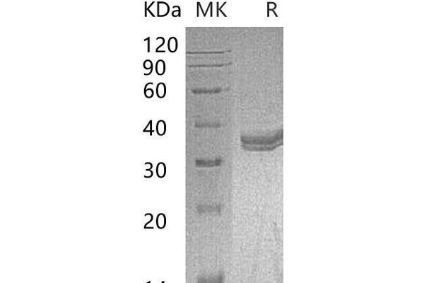 CA4 Protein (AA 18-277) (His tag)