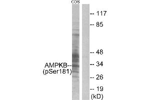 Immunohistochemistry analysis of paraffin-embedded human skeletal muscle tissue, using AMPK β1 (Phospho-Ser181) antibody. (PRKAB1 抗体  (pSer181))