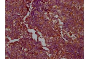 Immunohistochemistry (IHC) image for anti-Pyruvate Kinase M1/2 (PKM) antibody (ABIN7127769)