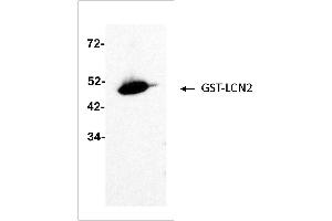 Antigen: GST-LCN2 (ABIN2703637) full length recombinant protein 2 ng  Primary Antibody: Anti-LCN2 monoclonal (PA348-26. (Lipocalin 2 抗体)
